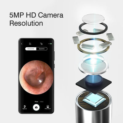 3.9mm HD Otoscopio digitale dell'orecchio WiFi con funzione direzionale AI e connettività WiFi