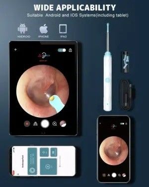 Kit di rimozione di cera per l' orecchio per la pulizia domestica con 1296P Otoscope Camera e luce per la pulizia delle orecchie